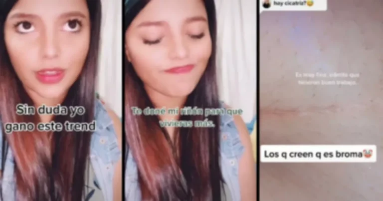 Após doar rim para namorado, mulher descobre que homem era casado