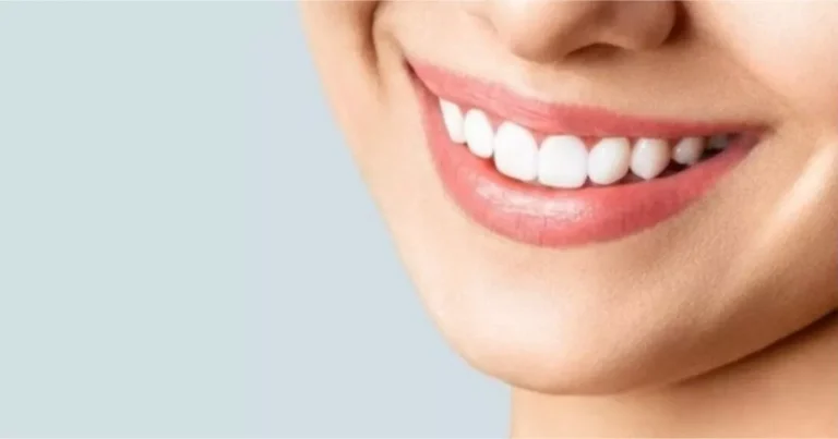 5 alimentos que clareiam os dentes naturalmente, sem precisar gastar uma fortuna com dentista