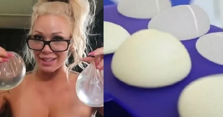 Influencer sente dores, manda remover o silicone dos seios e o que encontra dentro das próteses é apavorante