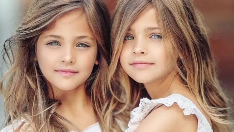 Lembra das gêmeas mais lindas do mundo? Elas cresceram e você não vai acreditar como estão hoje