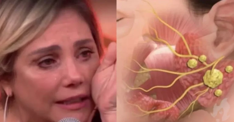 Descubra quais são os sintomas do câncer nas glândulas salivares, que acometeu a atriz Heloísa Périssé