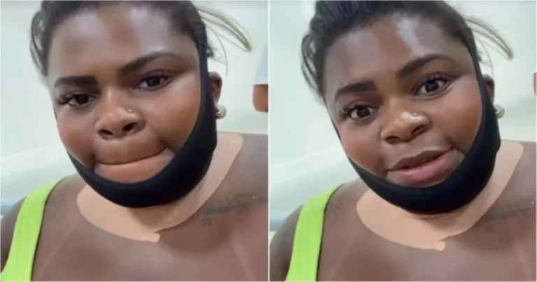 O que aconteceu com Jojo Todynho? Cantora aparece com rosto enfaixado e deixa fãs preocupados