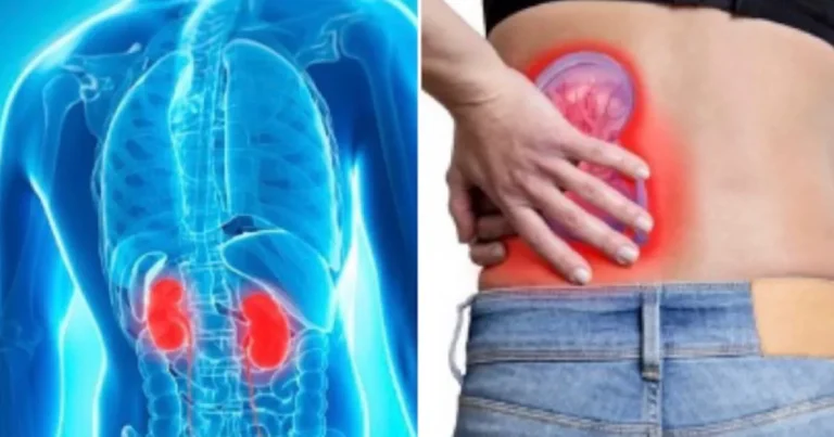 10 hábitos que podem deixar seus rins doentes e como fazer para evitá-los