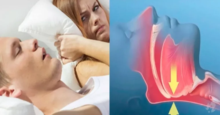 Os perigos ocultos da apneia do sono: 6 sinais de alerta que você não pode ignorar