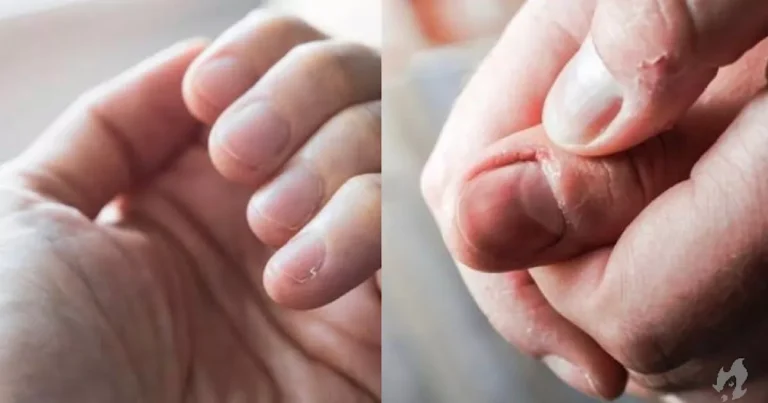 Alterações na cor das unhas: Nunca ignore estes sinais que podem indicar sua saúde comprometida