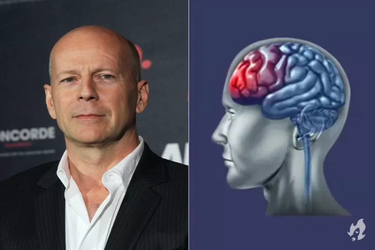 Bruce Willis: como o ator fez para esconder doença em seus últimos trabalhos?