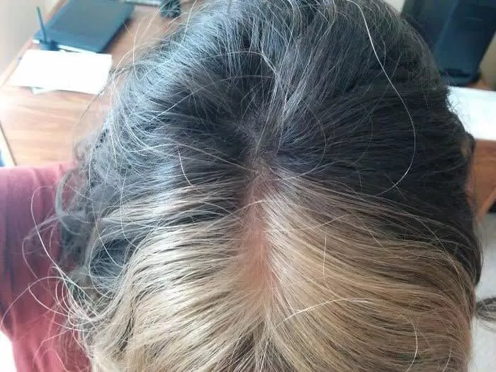 Ela Nasceu com Cabelo Loiro e Marrom