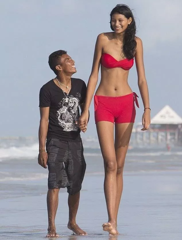Gigantismo