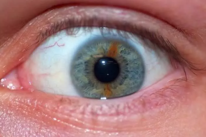 Listra Na Iris