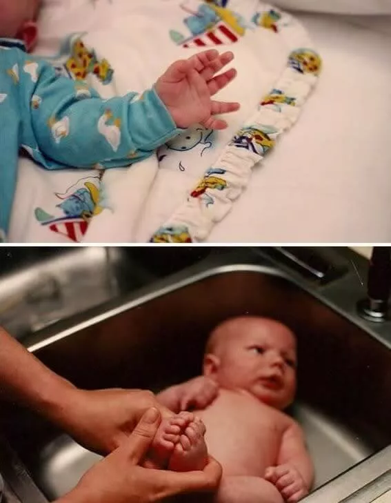 Doze Dedos nas Mãos e Pés