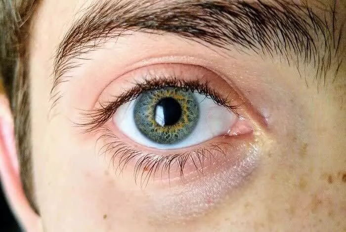 Anel de Ouro em Sua Iris