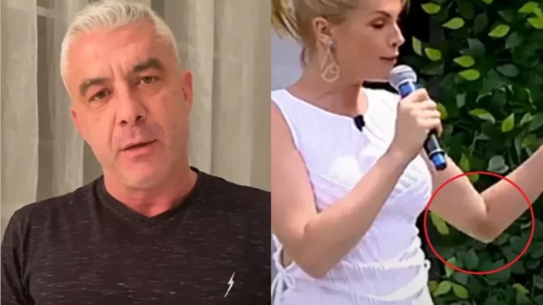 Marido de Ana Hickmann explica machucado no braço da apresentadora à polícia