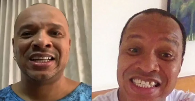 Anderson Leonardo, do Molejo, segue tratamento durante luta contra o câncer