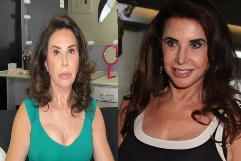 Claudia Alencar: Atriz segue sem previsão de alta e perde trabalho