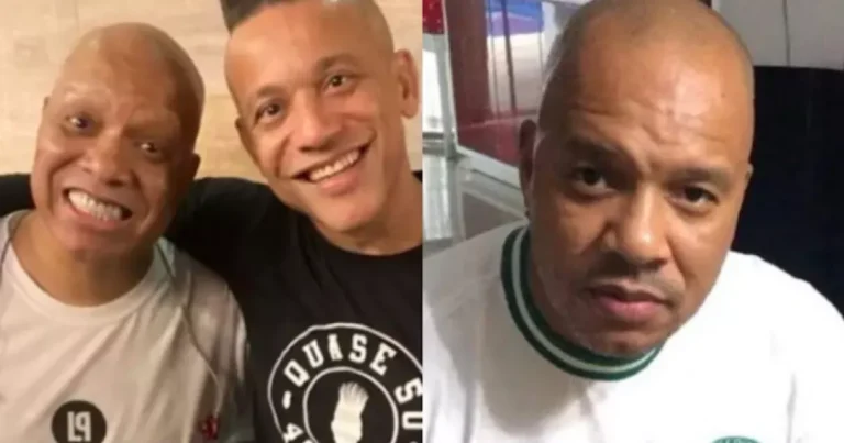 Integrante do Molejo expõe quadro de saúde de Anderson Leonardo e pede orações