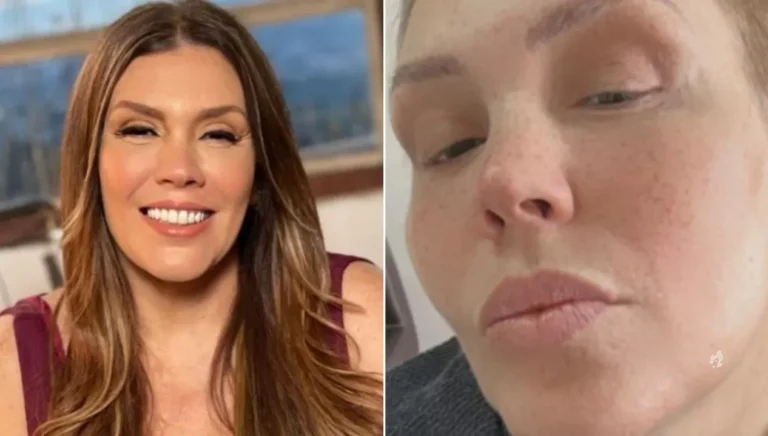 Após tratamento contra câncer, Simony mostra o cabelo natural: “Muito grande”