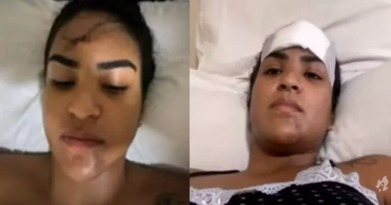 Mulher que pulou grávida do 5º andar para fugir do marido relata o que realmente aconteceu: ‘Você já está morta’