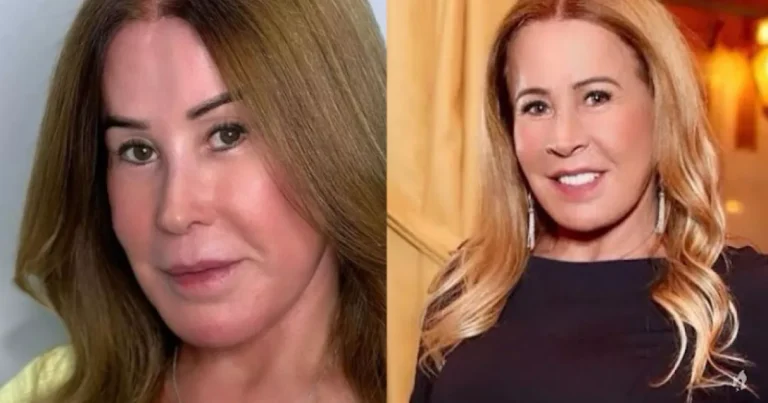 Zilu confessa fazer uso de Photoshop em fotos: “Foi feito pra usar”