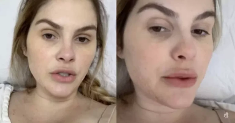 Bárbara Evans passa por cirurgia plástica; É revelado o que ela fez!