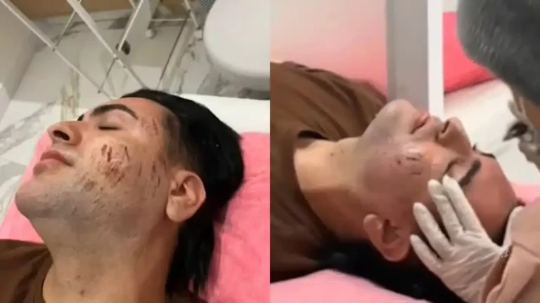 Vídeo: Vazam imagens feitas durante tratamento de homem morto por fenol