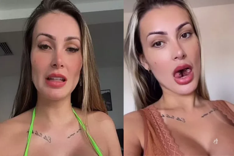 Massacrada por causa da língua cortada, Andressa Urach dá conselho e rebate críticas: “Fé em Cristo”