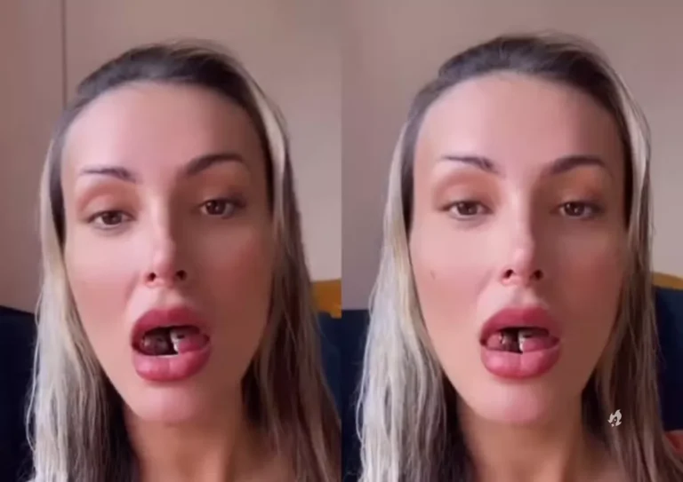 Andressa Urach toma medida desesperada após língua cortada inflamar