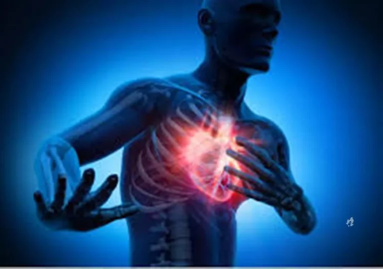 Saiba como reconhecer infarto quando não ocorre a dor no peito