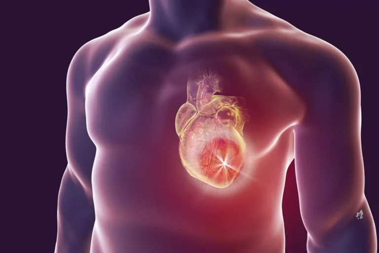Sintomas de infarto pouco conhecidos para você ficar atento