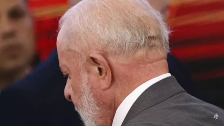 Lula precisa realizar novos exames após quase duas semanas do acidente doméstico