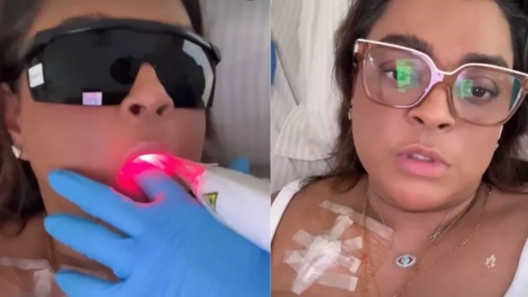 Preta Gil faz tratamento com laser dentro da boca e revela o motivo
