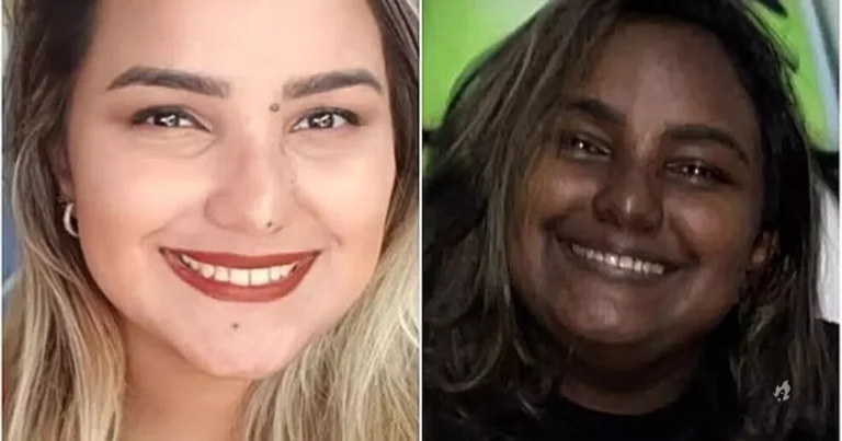 Jovem com tumor raro que acarretou na mudança na cor de pele tenta obter remédio de alto custo na Justiça