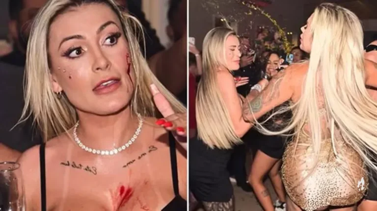 Após sofrer agressão, Andressa Urach entrega qual medida irá tomar contra Juju Ferrari