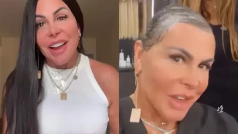 Gretchen remove mega hair e mostra realidade da alopecia: ‘Não me importo’
