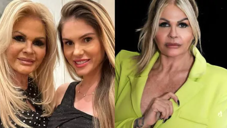 Monique Evans faz harmonização facial, e resultado chocante repercute