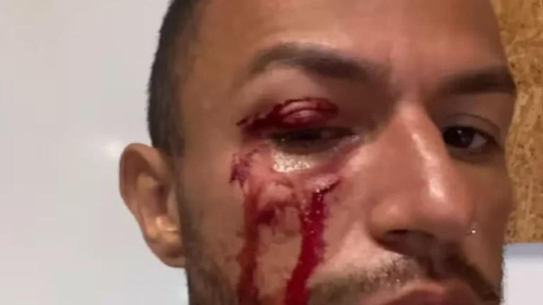 Artistas brasileiros são agredidos por dono de circo em Portugal: ‘Disse que ia nos matar’