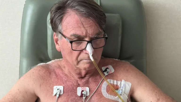 Bolsonaro tem “boa evolução” e segue com fisioterapia, diz boletim médico