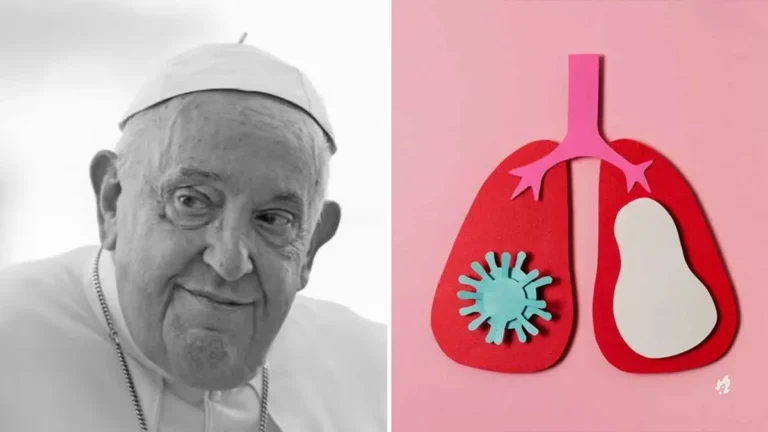Pneumonia bilateral: entenda a doença que tirou a vida do papa Francisco