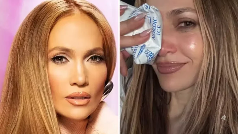 Jennifer Lopez sofre acidente em ensaio e é socorrido às pressas