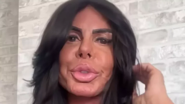 Gretchen ignora críticas e exibe novos procedimentos: Fininho
