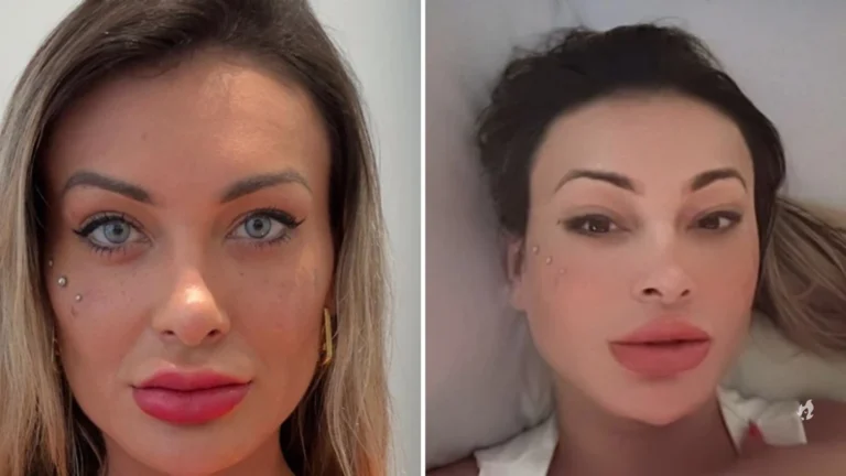 Andressa Urach segue os passos de Maya e faz cirurgia radical em seus olhos: “Sonho”
