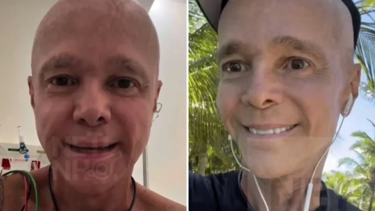 Netinho rompe o silêncio e comenta nova rotina após fim do tratamento de quimioterapia: ‘Muito fraco’