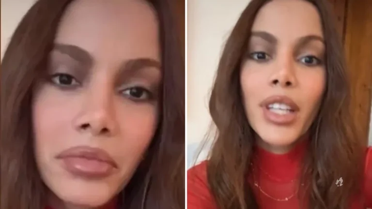 Vídeo: Anitta se manifesta sobre ter ficado “desfigurada” após procedimento