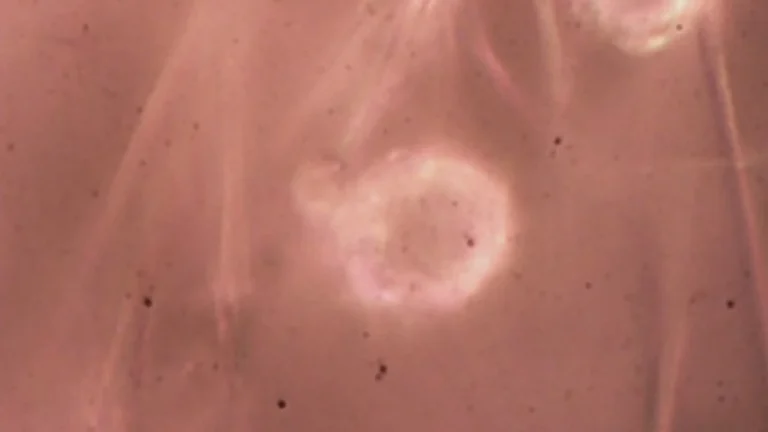 Pela 1ª vez no Brasil, cientistas acham microplástico em cordão umbilical