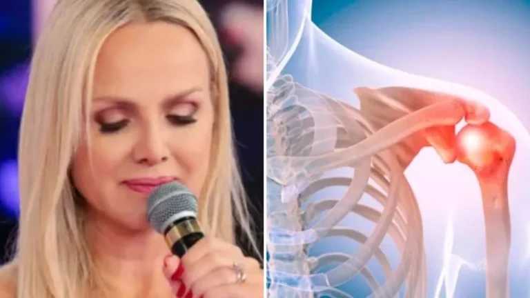 Síndrome do ombro congelado x menopausa: Saiba o que é a paralisia que afetou a saúde de Eliana