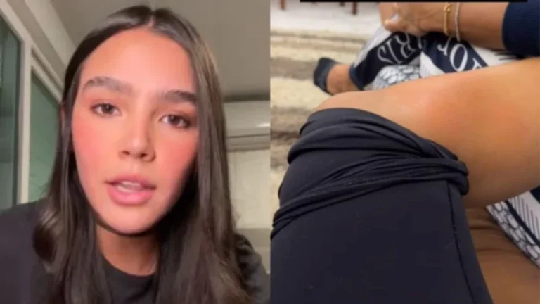 Com tumor no joelho, ex-nora de Angélica revela ter recusado cirurgia: Um risco