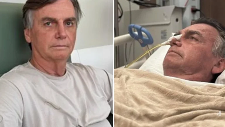Médica rompe o silêncio e entrega detalhes sobre quadro de Bolsonaro: ‘queimação’