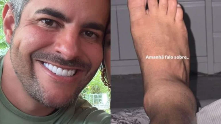 Lesão grave! Marido de Simone Mendes detalha entorse no tornozelo e mostra sofrimento em vídeo