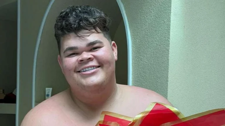 Gordão da XJ passará por cirurgia após perder 130 kg: Estou com medo
