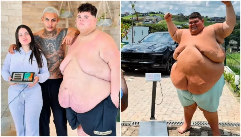 Após perder 130 kg, influenciador Gordão da XJ passa por cirurgia de risco