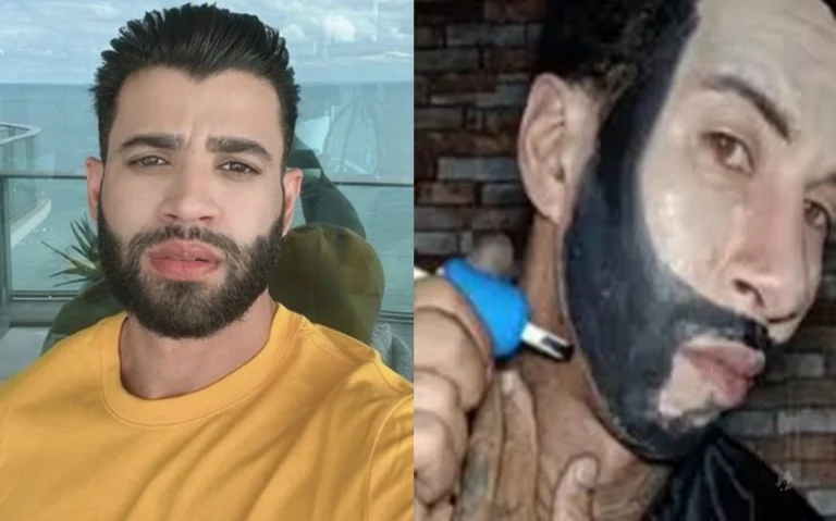 Fã tatua o próprio rosto para ficar igual a Gusttavo Lima e choca a web